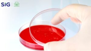 Sheep Blood Agar