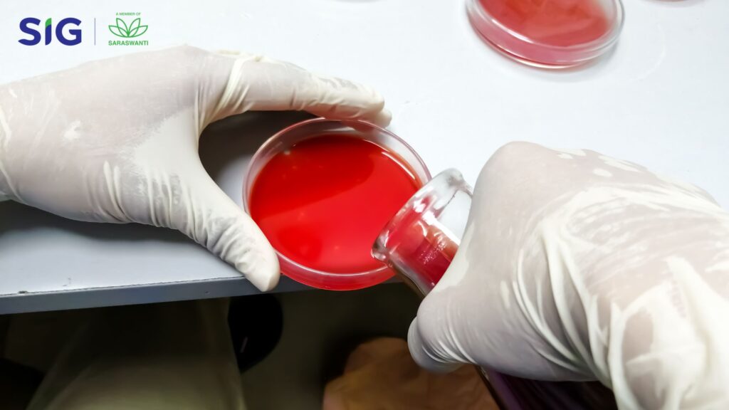 Sheep Blood Agar: Senjata Rahasia Para Ahli Mikrobiologi - SIG LABORATORY