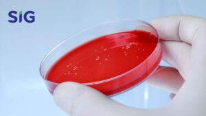 Sheep Blood Agar